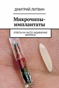 Микрочипы-имплантаты. Ответы на часто задаваемые вопросы