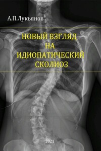 Новый взгляд на идиопатический сколиоз