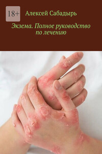 Экзема. Полное руководство по лечению